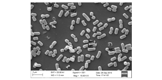 Image of Gas chromatograms of cholesterol to coprostanol bio-converters L. plantarum HIF 81