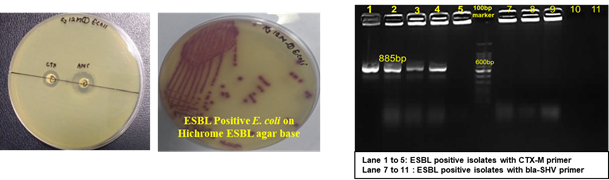 Image of Prevalence of ESBL positive E. coli in milk