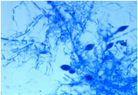 Image of Anaeromyces sp.